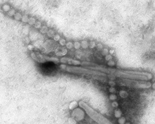 h7n9-avian-virus-em